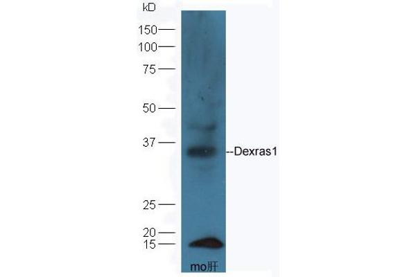 anti-RAS, Dexamethasone-Induced 1 (RASD1) (AA 21-120) antibody