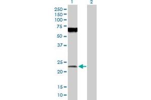 Image no. 1 for anti-Protein O-Fucosyltransferase 1 (POFUT1) (AA 1-194) antibody (ABIN525219)