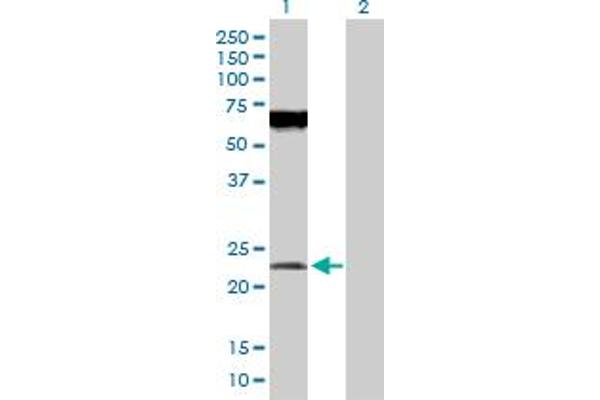 POFUT1 antibody  (AA 1-194)