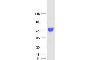 Image no. 1 for Neuronal Pentraxin 1 (NPX1) protein (Myc-DYKDDDDK Tag) (ABIN2727183)