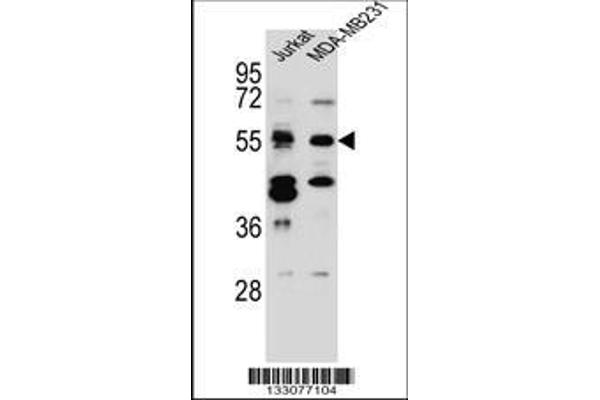 anti-CUGBP, Elav-Like Family Member 3 (CELF3) (AA 3-32), (N-Term) antibody