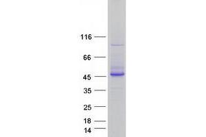 Image no. 1 for 3'(2'), 5'-Bisphosphate Nucleotidase 1 (BPNT1) protein (Myc-DYKDDDDK Tag) (ABIN2715323)