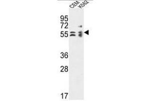 Image no. 1 for anti-Tubulin Folding Cofactor E (TBCE) (AA 371-400), (Middle Region) antibody (ABIN955104)