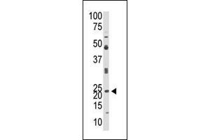 Image no. 1 for anti-Neurogenin 1 (NEUROG1) (AA 31-60), (N-Term) antibody (ABIN388767)