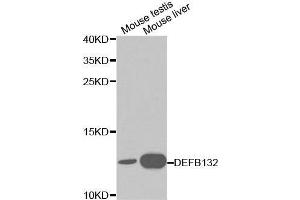 Image no. 1 for anti-Defensin, beta 132 (DEFB132) antibody (ABIN3021369)