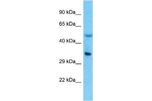 Host:  Rabbit  Target Name:  LPPR5  Sample Type:  Thymus Tumor lysates  Antibody Dilution:  1.