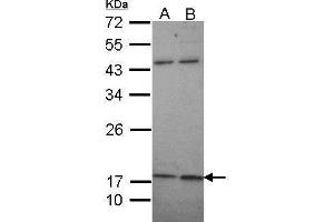 Image no. 1 for anti-Potassium Large Conductance Calcium-Activated Channel, Subfamily M, beta Member 1 (KCNMB1) (Center) antibody (ABIN2856153)