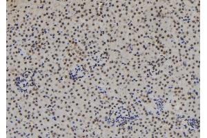 Image no. 5 for anti-Nuclear Factor of Activated T-Cells, Cytoplasmic, Calcineurin-Dependent 4 (NFATC4) (pSer289) antibody (ABIN6270190)