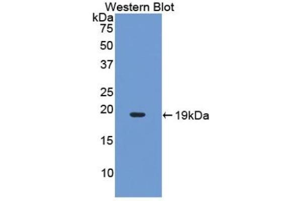 IL-17 antibody  (AA 20-155)