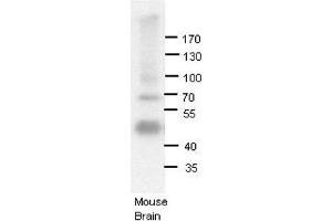Image no. 3 for anti-Adenosine Deaminase, RNA-Specific, B1 (ADARB1) (N-Term) antibody (ABIN2778757)