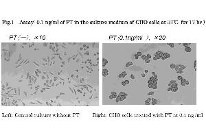 Cell Culture (CC) image for Pertussis Toxin (ARTC) (Active) protein (ABIN2452202)