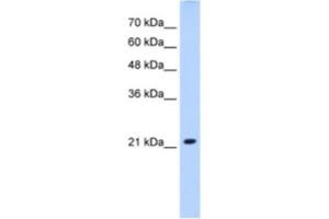 Image no. 1 for anti-Solute Carrier Family 25 (Mitochondrial Carrier, Brain), Member 14 (SLC25A14) antibody (ABIN2462743)