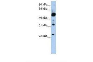 Image no. 1 for anti-Transmembrane Protein 38B (TMEM38B) (C-Term) antibody (ABIN6738352)