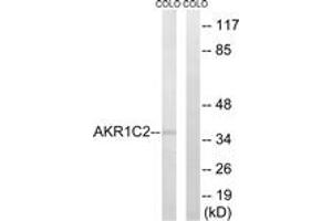 Image no. 1 for anti-Aldo-keto Reductase Family 1, Member C2 (AKR1C2) (AA 21-70) antibody (ABIN1534616)