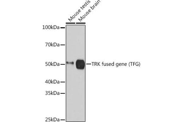 TFG anticorps