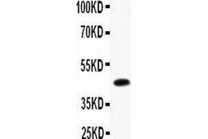 Image no. 1 for anti-CD79b Molecule, Immunoglobulin-Associated beta (CD79B) (AA 29-229) antibody (ABIN3043398)