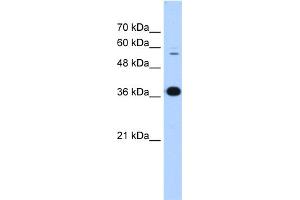 Image no. 4 for anti-Prolyl 4-Hydroxylase, beta Polypeptide (P4HB) (N-Term) antibody (ABIN2783245)
