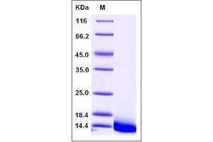 Image no. 1 for Defensin, beta 103A (DEFB103A) (AA 23-67), (Mature) protein (His tag) (ABIN2003489)
