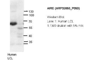 Image no. 2 for anti-Autoimmune Regulator (AIRE) (N-Term) antibody (ABIN2779777)