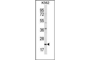 Image no. 2 for anti-Major Histocompatibility Complex, Class II, DQ alpha 1 (HLA-DQA1) (AA 56-84), (Middle Region) antibody (ABIN952750)
