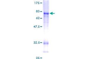 Image no. 1 for C-terminal Binding Protein 2 (CTBP2) (AA 1-445) protein (GST tag) (ABIN1350623)