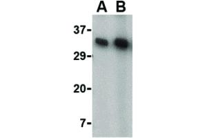 Image no. 3 for anti-CD82 (CD82) (C-Term) antibody (ABIN6657034)