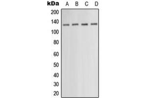 Image no. 2 for anti-Protein Kinase N1 (PKN1) (Center) antibody (ABIN2706821)