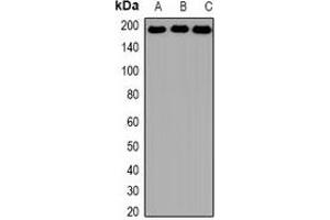Image no. 3 for anti-SWI/SNF Related, Matrix Associated, Actin Dependent Regulator of Chromatin, Subfamily A, Member 4 (SMARCA4) antibody (ABIN3197919)