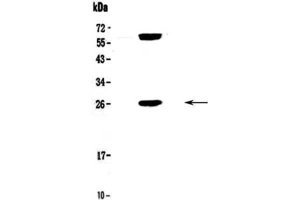 anti-B-Cell CLL/lymphoma 2 (BCL2) (AA 118-165) antibody