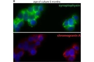 Image no. 7 for anti-Synaptophysin (SYP) (C-Term) antibody (ABIN2854881)