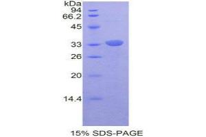 Image no. 1 for V-Rel Reticuloendotheliosis Viral Oncogene Homolog B (RELB) (AA 176-436) protein (His tag,T7 tag) (ABIN1877878)