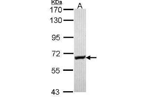 Image no. 1 for anti-Glycerol Kinase (GK) (Internal Region) antibody (ABIN2855352)