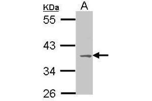 Image no. 3 for anti-Melanocortin 1 Receptor (MC1R) (C-Term) antibody (ABIN2856574)