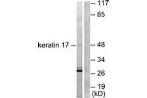Image no. 3 for anti-Keratin 17 (KRT17) (AA 381-430) antibody (ABIN1533322)