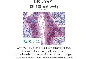Image no. 3 for anti-Yes-Associated Protein 1 (YAP1) (AA 53-162) antibody (ABIN1723562)