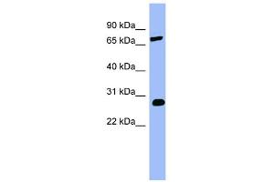 Image no. 1 for anti-Catechol-O-Methyltransferase (COMT) (Middle Region) antibody (ABIN2781821)