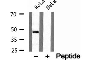 Western blot analysis of extracts of HeLa cells, using TIP47 antibody.