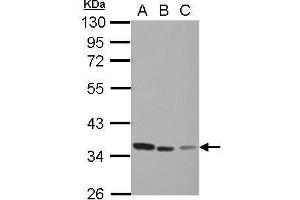 Image no. 2 for anti-Thymidylate Synthetase (TYMS) (Center) antibody (ABIN2855587)