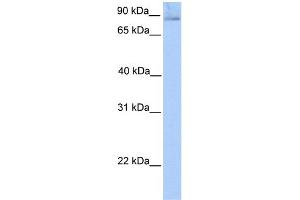 Image no. 1 for anti-SLIT and NTRK-Like Family, Member 1 (SLITRK1) (N-Term) antibody (ABIN2784098)