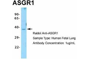 Image no. 2 for anti-Asialoglycoprotein Receptor 1 (ASGR1) (N-Term) antibody (ABIN2778132)