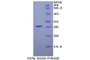 Image no. 1 for CD79b Molecule, Immunoglobulin-Associated beta (CD79B) (AA 26-225) protein (His tag,T7 tag) (ABIN1879158)