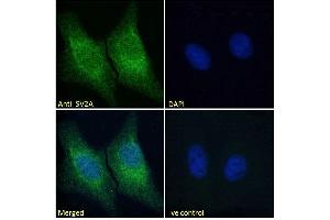 Image no. 1 for anti-Synaptic Vesicle Glycoprotein 2A (SV2A) (Internal Region) antibody (ABIN185715)