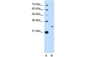 Image no. 3 for anti-F-Box Protein 3 (FBXO3) (N-Term) antibody (ABIN631363)