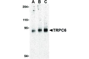 Image no. 1 for anti-Transient Receptor Potential Cation Channel, Subfamily C, Member 6 (TRPC6) (C-Term) antibody (ABIN6656402)