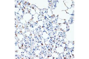 Surfactant Protein C antibody  (AA 1-197)