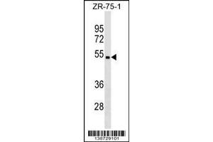 Image no. 1 for anti-Carbohydrate (N-Acetylglucosamine 6-O) Sulfotransferase 5 (CHST5) (AA 275-302), (C-Term) antibody (ABIN1536997)