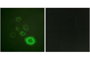 Immunofluorescence analysis of HepG2 cells, using c-Met (Phospho-Tyr1003) Antibody.