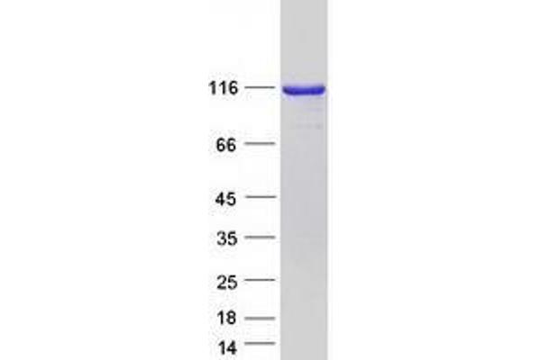 TSR1 Protein (TSR1, 20S rRNA Accumulation, Homolog) (Myc-DYKDDDDK Tag)