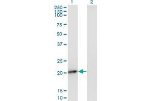 Western Blot analysis of PMVK expression in transfected 293T cell line by PMVK monoclonal antibody (M07), clone 2B8.