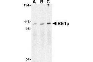 Image no. 3 for anti-Endoplasmic Reticulum To Nucleus Signaling 1 (ERN1) (C-Term) antibody (ABIN500048)